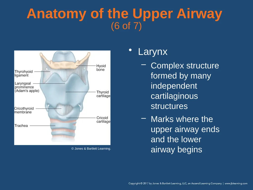Chapter 10 Airway Management National EMS - slide 18 of 170