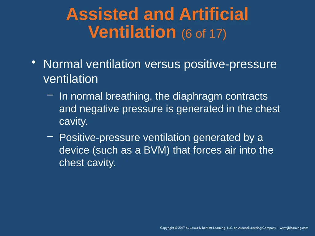 Chapter 10 Airway Management National EMS - slide 100 of 170