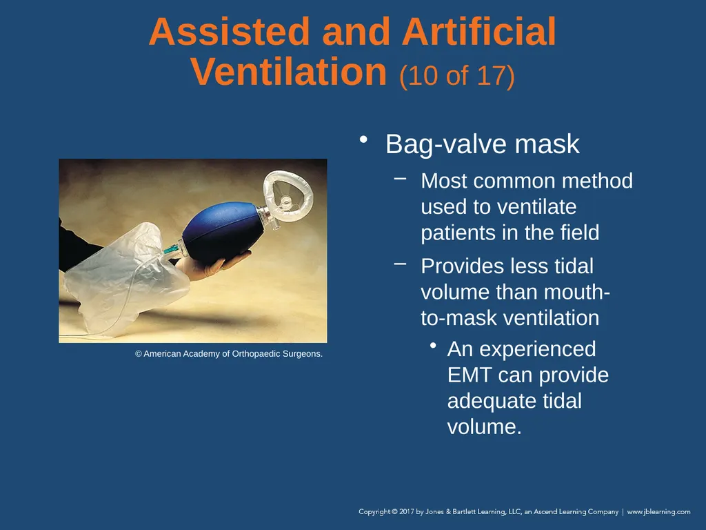 Chapter 10 Airway Management National EMS - slide 104 of 170
