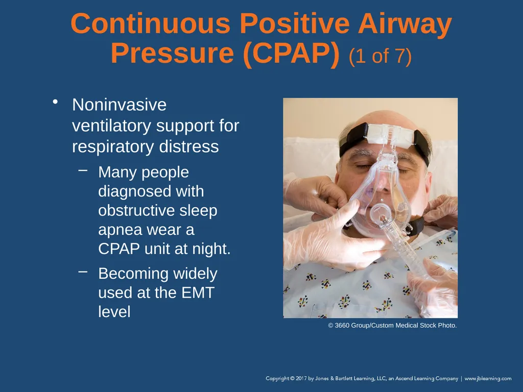 Chapter 10 Airway Management National EMS - slide 112 of 170