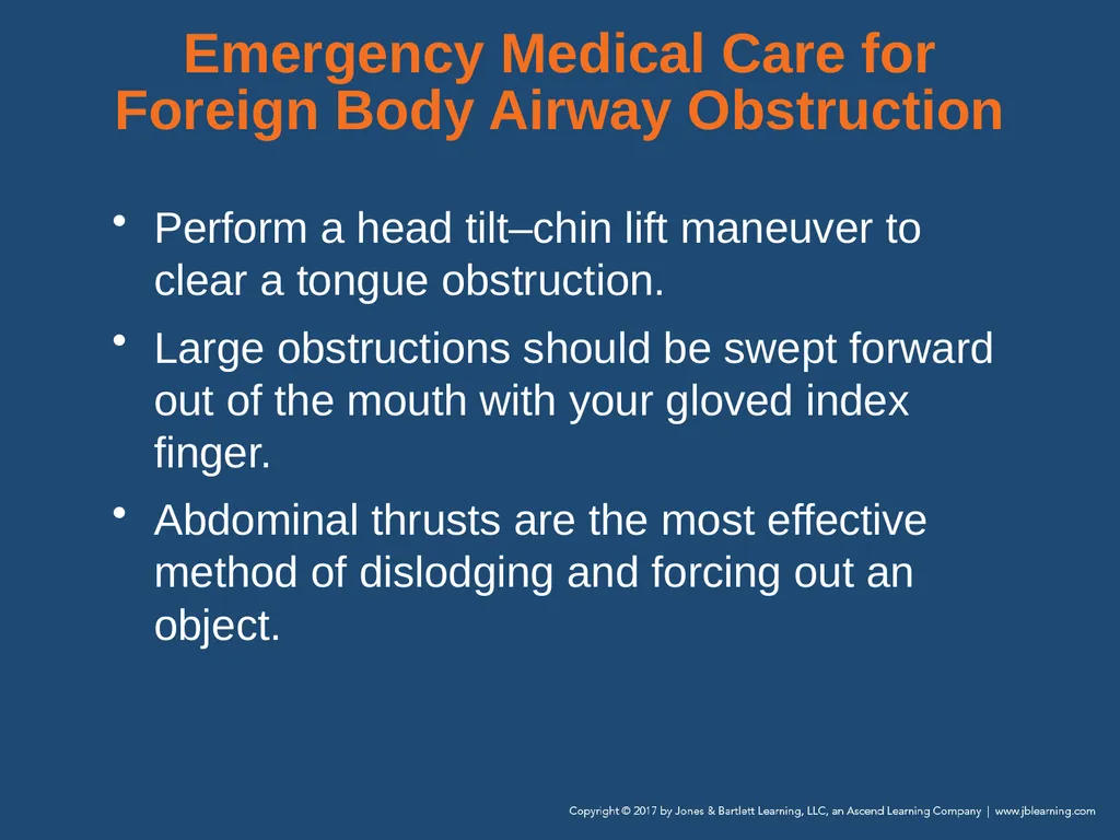 Chapter 10 Airway Management National EMS - slide 128 of 170