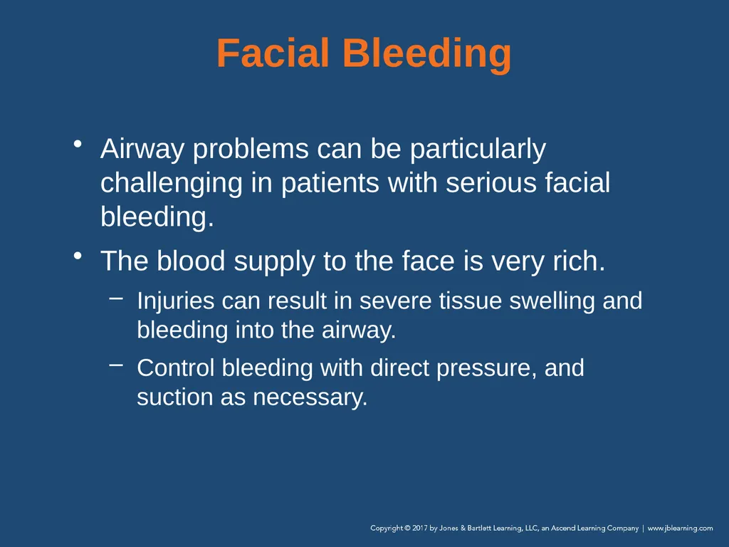 Chapter 10 Airway Management National EMS - slide 130 of 170