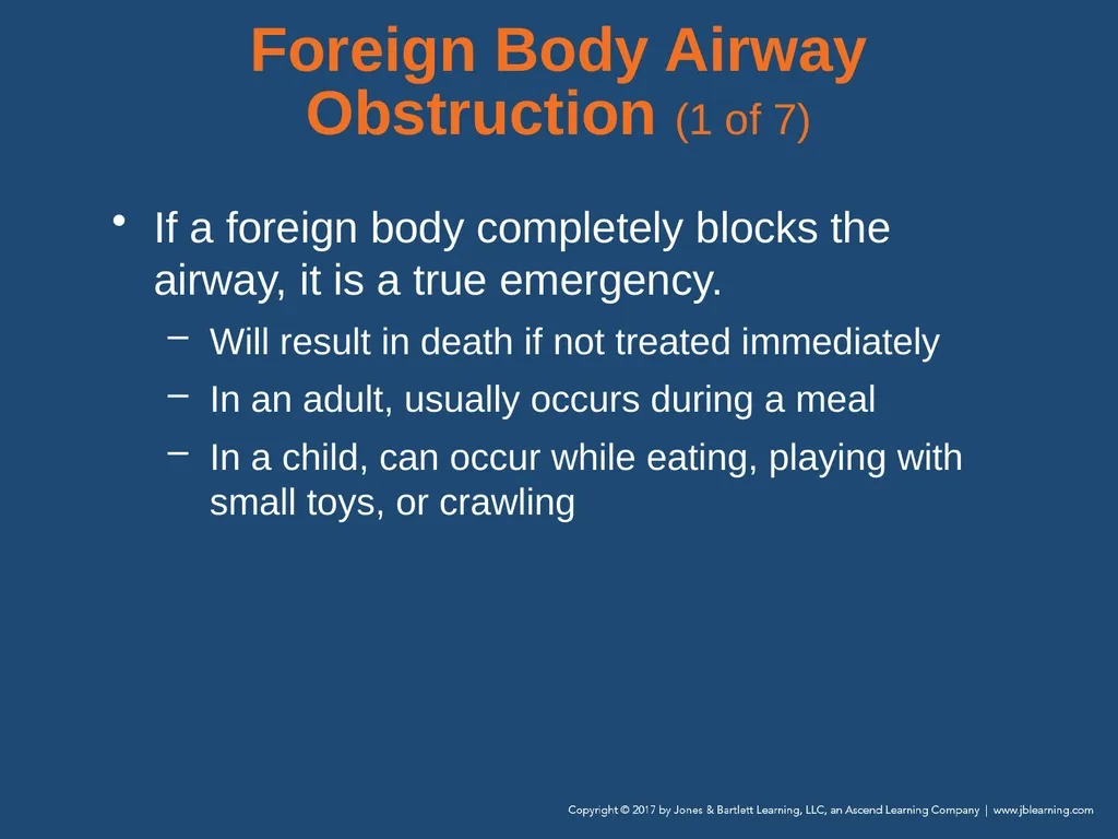 Chapter 10 Airway Management National EMS - slide 122 of 170