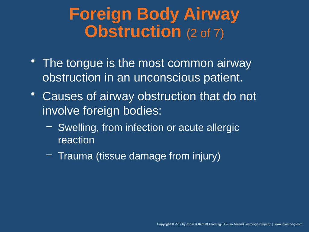Chapter 10 Airway Management National EMS - slide 123 of 170