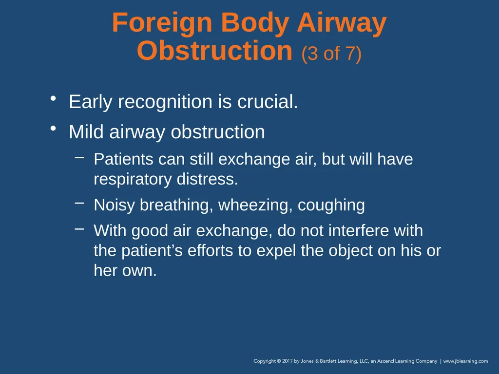 Chapter 10 Airway Management National EMS - slide 124 of 170