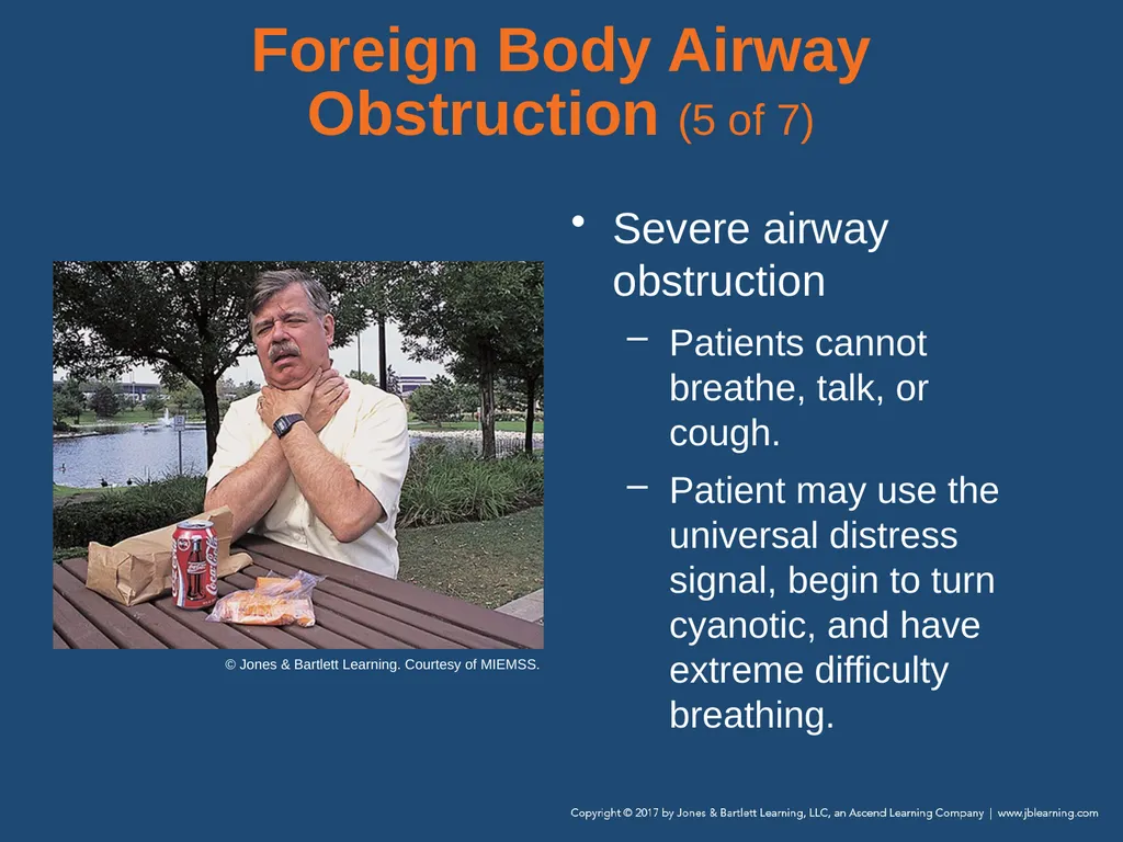 Chapter 10 Airway Management National EMS - slide 126 of 170