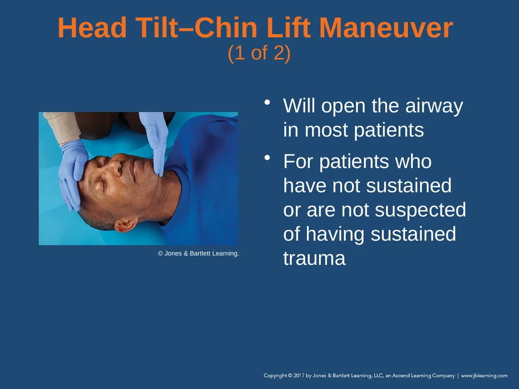 Chapter 10 Airway Management National EMS - slide 57 of 170