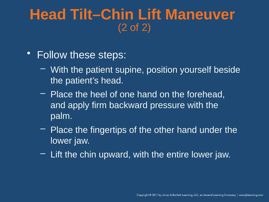 Chapter 10 Airway Management National EMS - slide 58 of 170