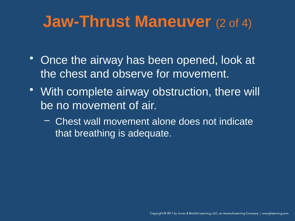 Chapter 10 Airway Management National EMS - slide 60 of 170