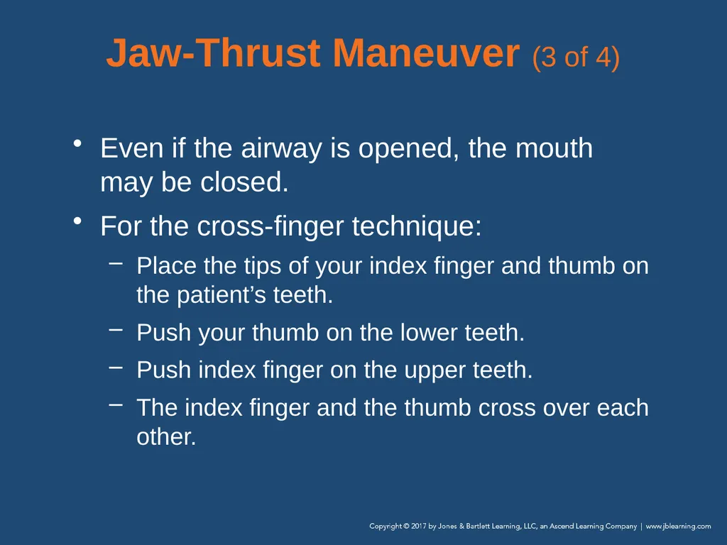 Chapter 10 Airway Management National EMS - slide 61 of 170
