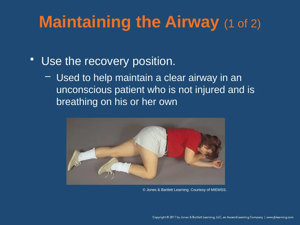 Chapter 10 Airway Management National EMS - slide 73 of 170