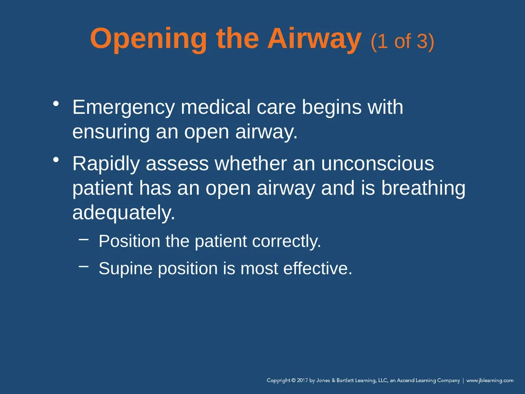 Chapter 10 Airway Management National EMS - slide 54 of 170