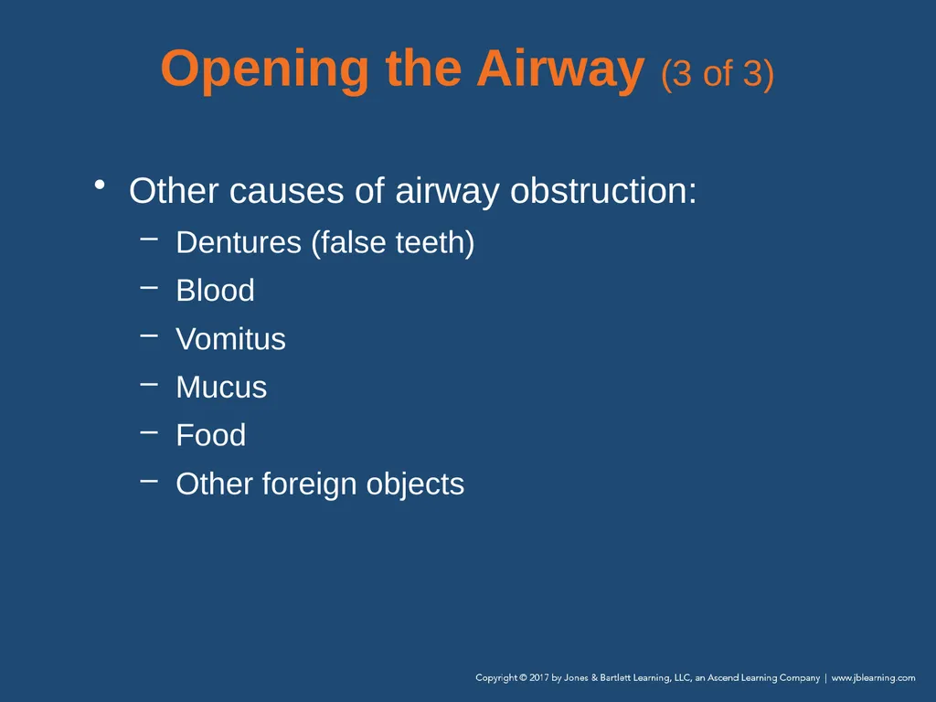 Chapter 10 Airway Management National EMS - slide 56 of 170