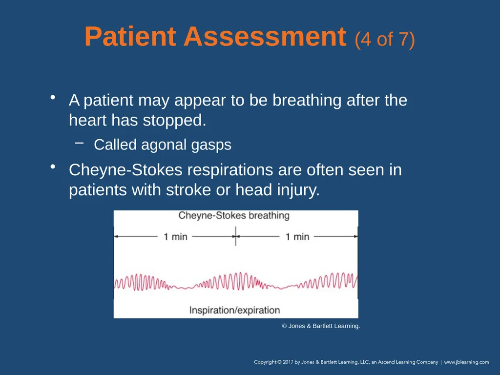 Chapter 10 Airway Management National EMS - slide 50 of 170