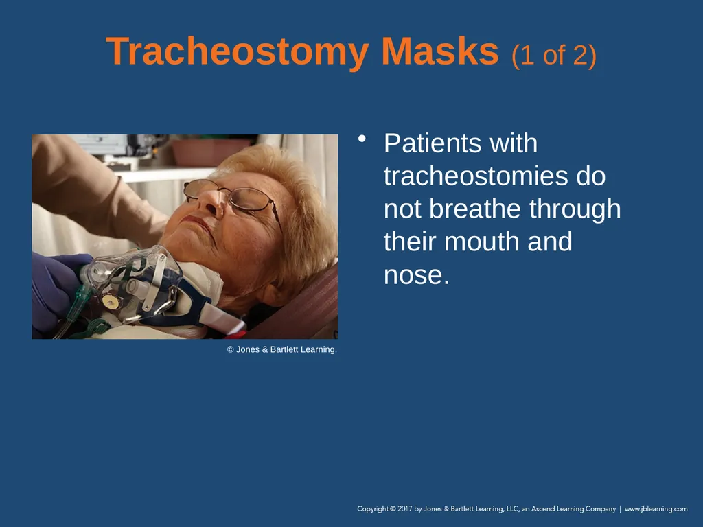 Chapter 10 Airway Management National EMS - slide 92 of 170