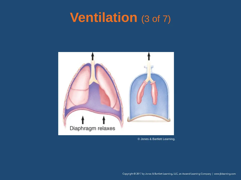 Chapter 10 Airway Management National EMS - slide 30 of 170