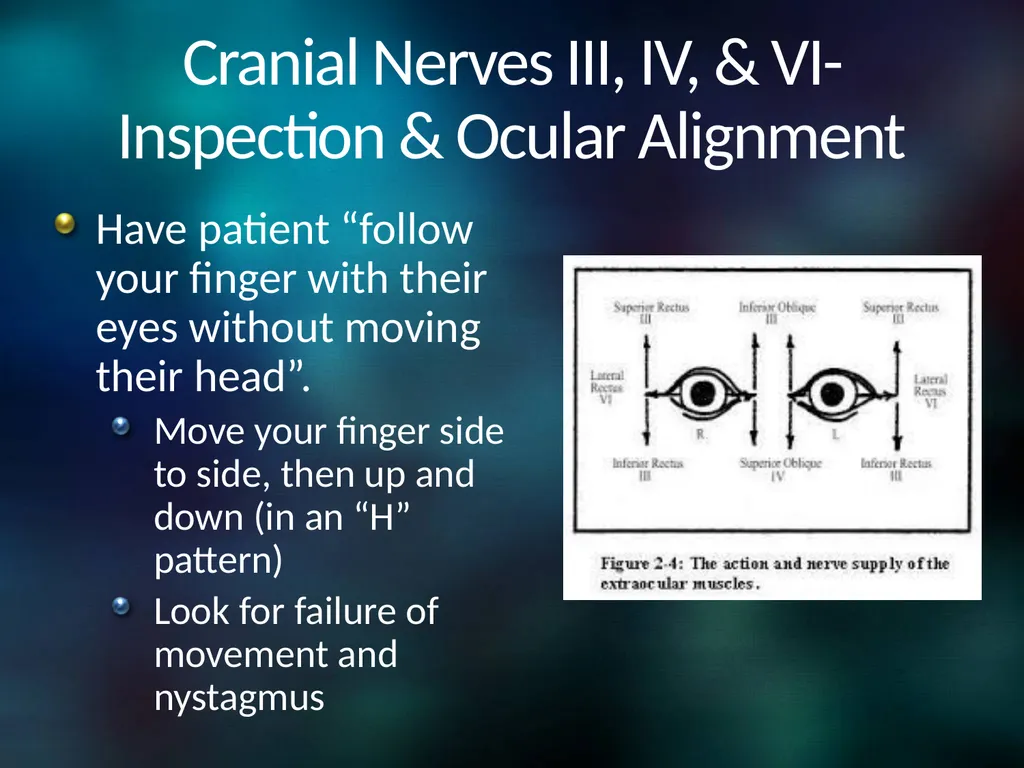 Neuro 101: Nursing Neuro Assessment Kristen - slide 22 of 29