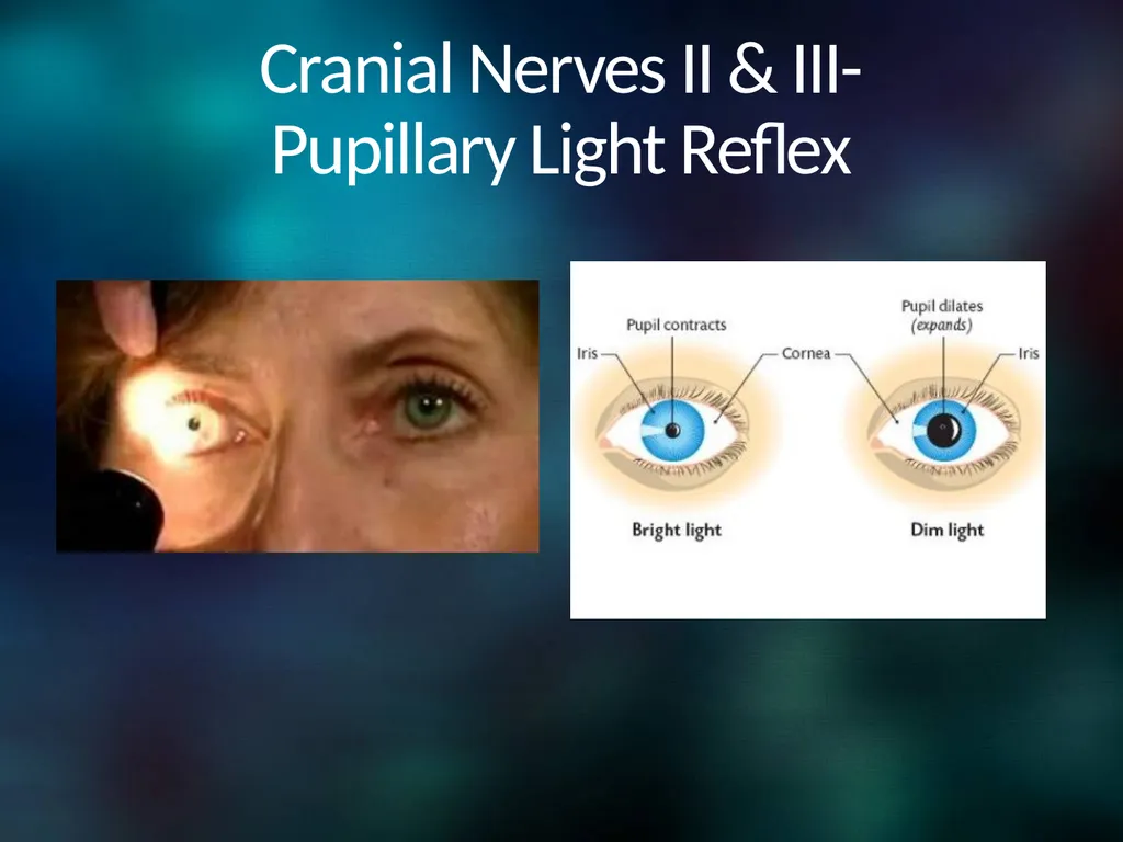 Neuro 101: Nursing Neuro Assessment Kristen - slide 21 of 29