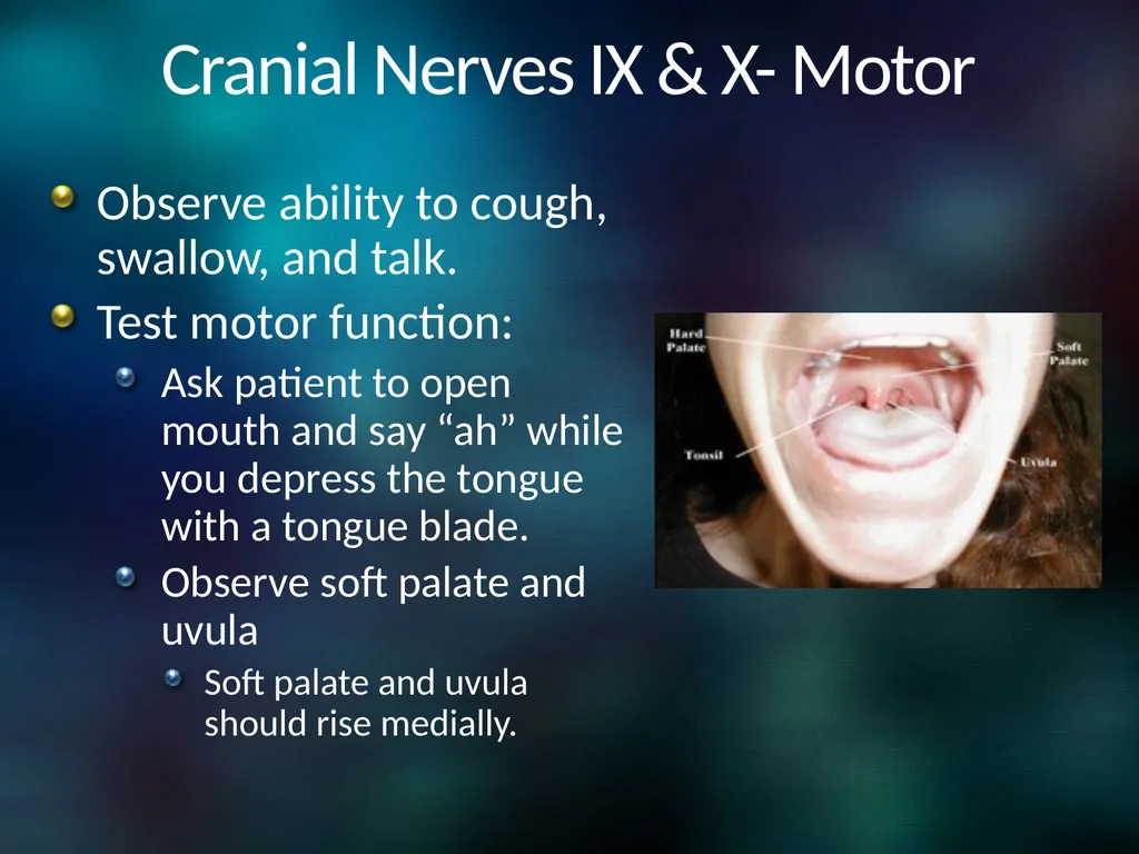 Neuro 101: Nursing Neuro Assessment Kristen - slide 25 of 29