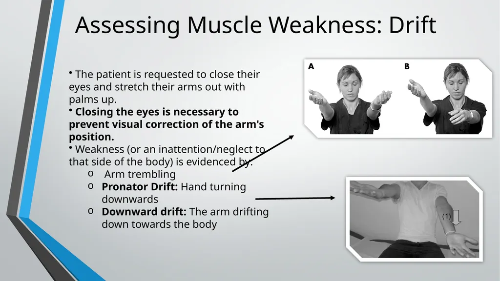 Neurological Assessment Overview By: Aliyah - slide 20 of 49