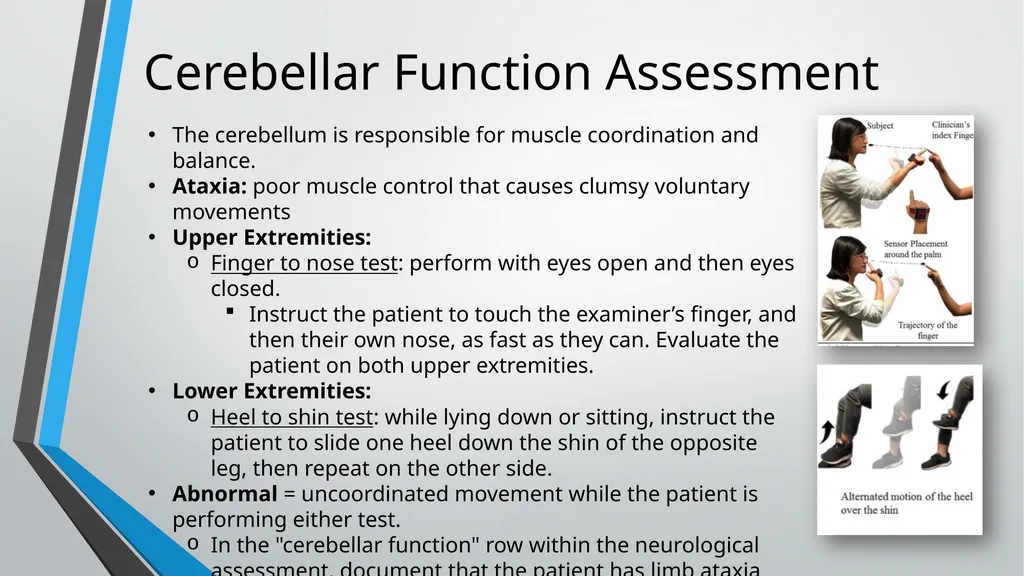 Neurological Assessment Overview By: Aliyah - slide 33 of 49