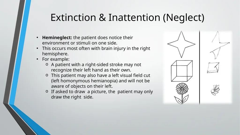 Neurological Assessment Overview By: Aliyah - slide 35 of 49