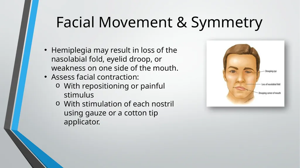 Neurological Assessment Overview By: Aliyah - slide 43 of 49