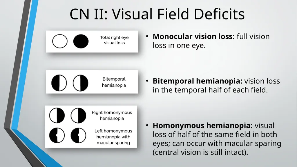 Neurological Assessment Overview By: Aliyah - slide 27 of 49