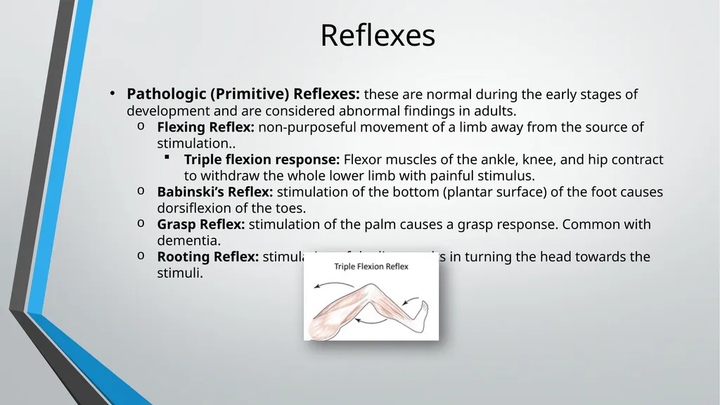 Neurological Assessment Overview By: Aliyah - slide 34 of 49