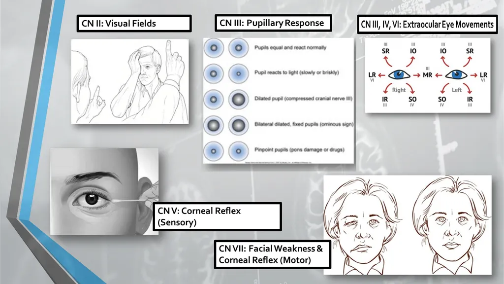 Neurological Assessment Overview By: Aliyah - slide 26 of 49