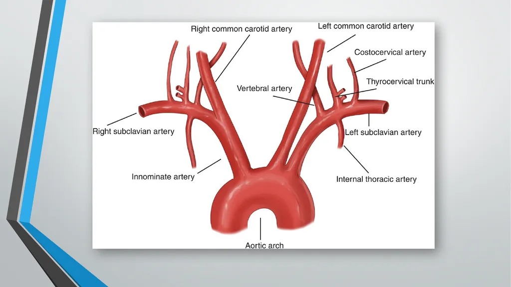 Neurological Assessment Overview By: Aliyah - slide 7 of 49