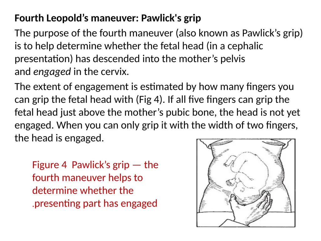 Assessing the Woman in Labor One of the most - slide 30 of 36