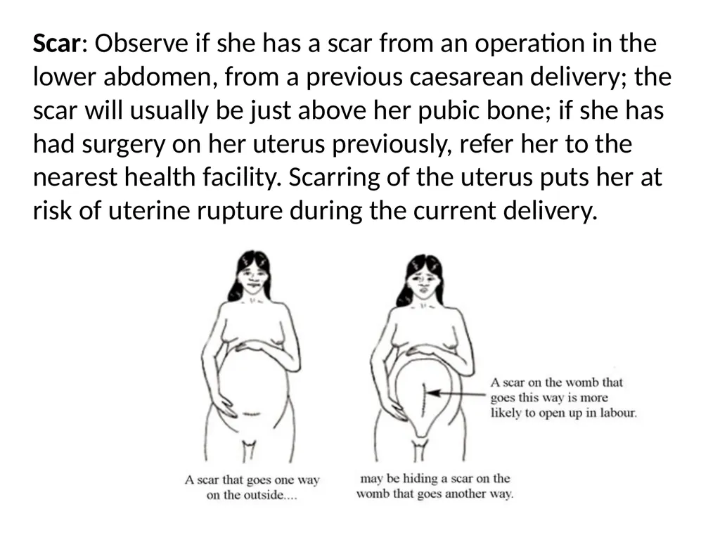 Assessing the Woman in Labor One of the most - slide 21 of 36