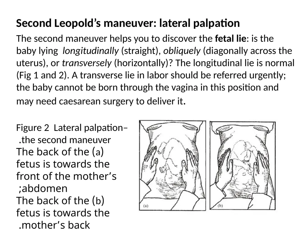 Assessing the Woman in Labor One of the most - slide 26 of 36