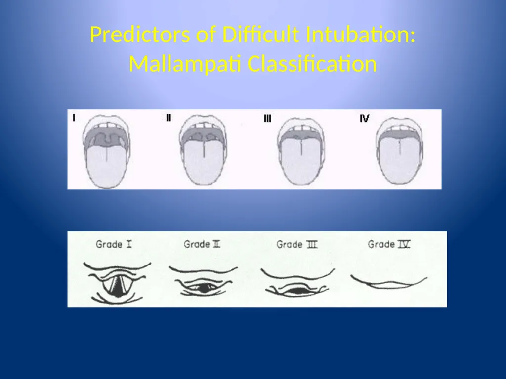 Complications of Rapid Sequence Induction and - slide 10 of 35