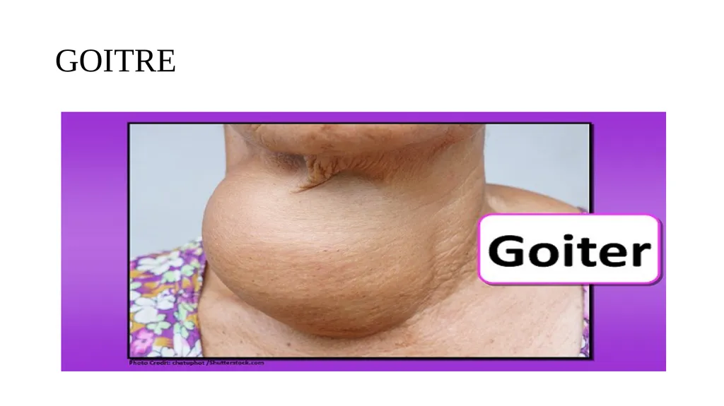 Head-to-Toe Assessment Nursing Introduction This - slide 33 of 62