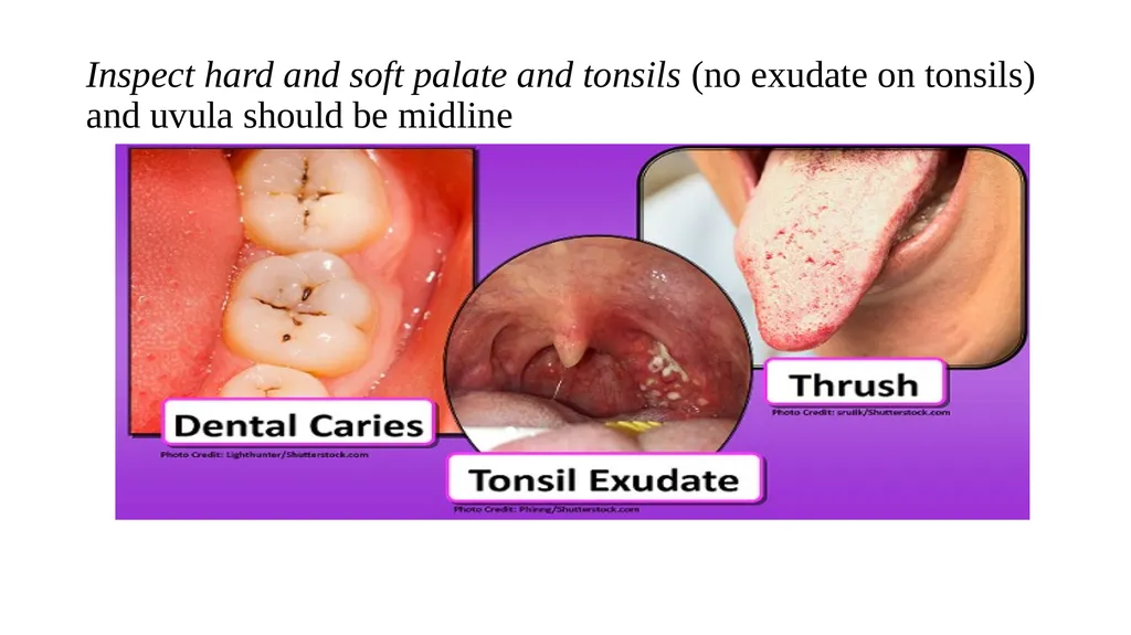 Head-to-Toe Assessment Nursing Introduction This - slide 30 of 62