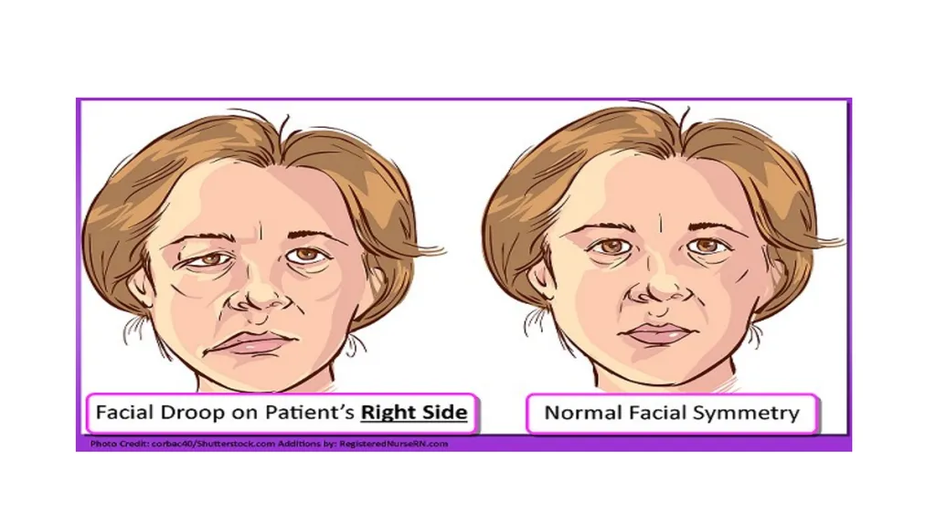 Head-to-Toe Assessment Nursing Introduction This - slide 11 of 62