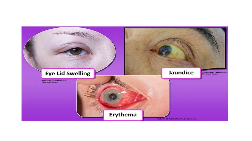 Head-to-Toe Assessment Nursing Introduction This - slide 18 of 62