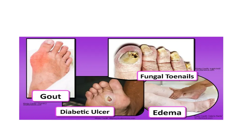 Head-to-Toe Assessment Nursing Introduction This - slide 59 of 62