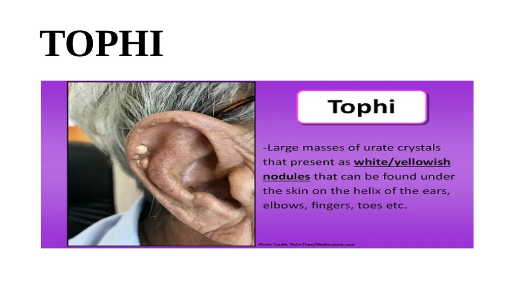 Head-to-Toe Assessment Nursing Introduction This - slide 23 of 62
