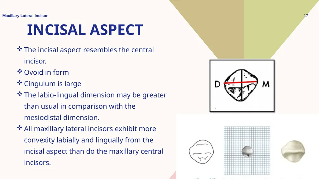 Maxillary Lateral Incisor Dr. Pinar Khalis BDS, - slide 17 of 20