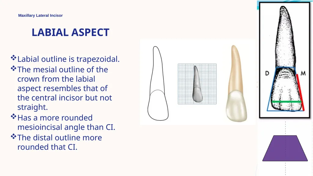 Maxillary Lateral Incisor Dr. Pinar Khalis BDS, - slide 7 of 20