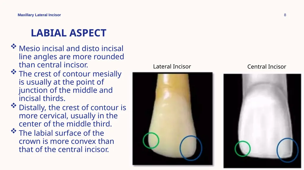 Maxillary Lateral Incisor Dr. Pinar Khalis BDS, - slide 8 of 20