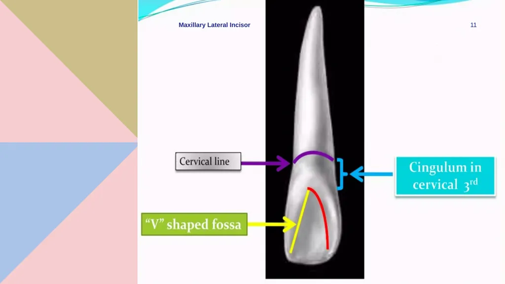 Maxillary Lateral Incisor Dr. Pinar Khalis BDS, - slide 11 of 20