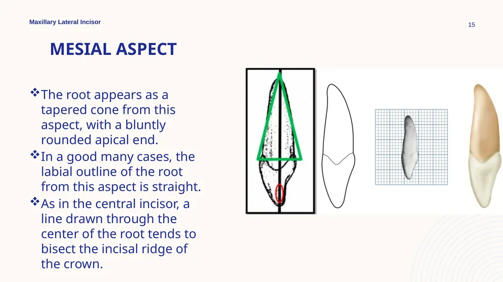 Maxillary Lateral Incisor Dr. Pinar Khalis BDS, - slide 15 of 20