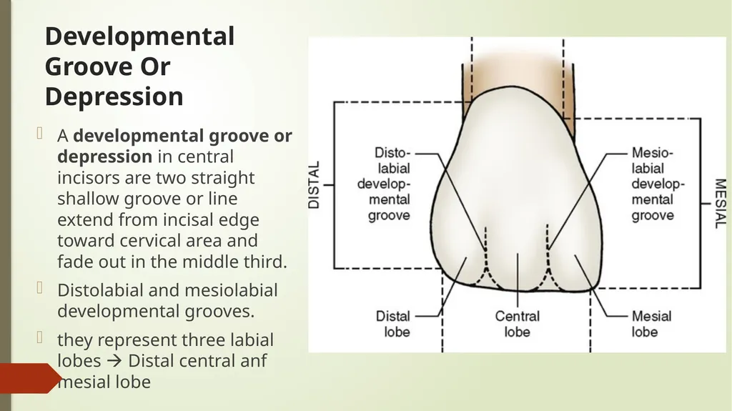The Permanent Maxillary Incisors Dr. Pinar Khalis - slide 13 of 28