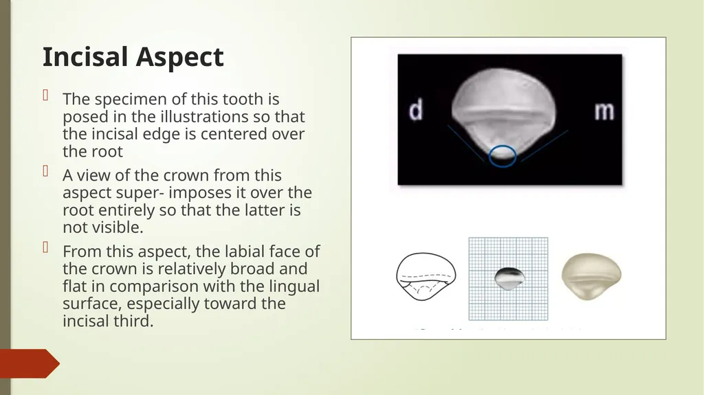 The Permanent Maxillary Incisors Dr. Pinar Khalis - slide 24 of 28