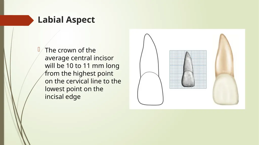The Permanent Maxillary Incisors Dr. Pinar Khalis - slide 7 of 28