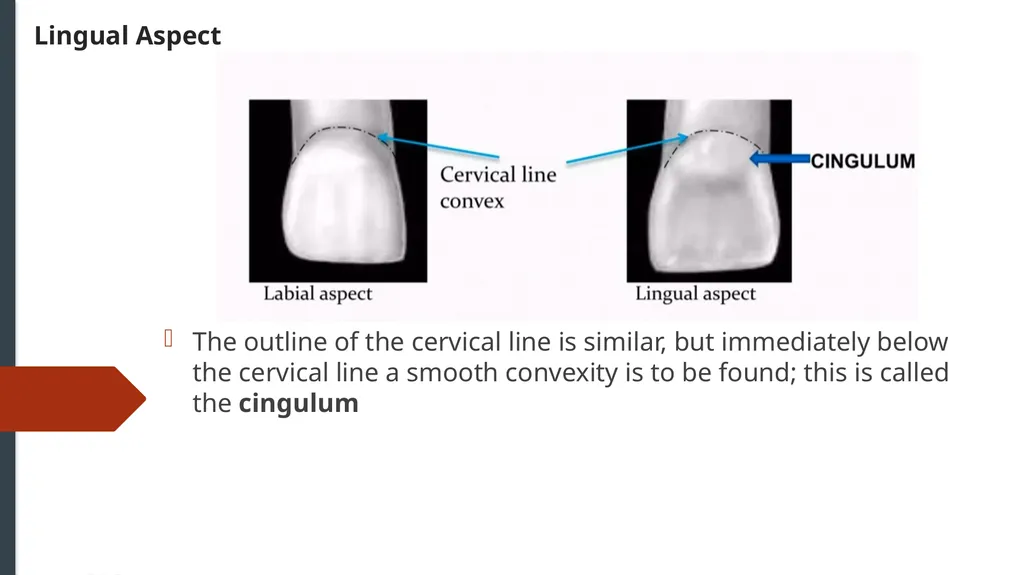 The Permanent Maxillary Incisors Dr. Pinar Khalis - slide 16 of 28